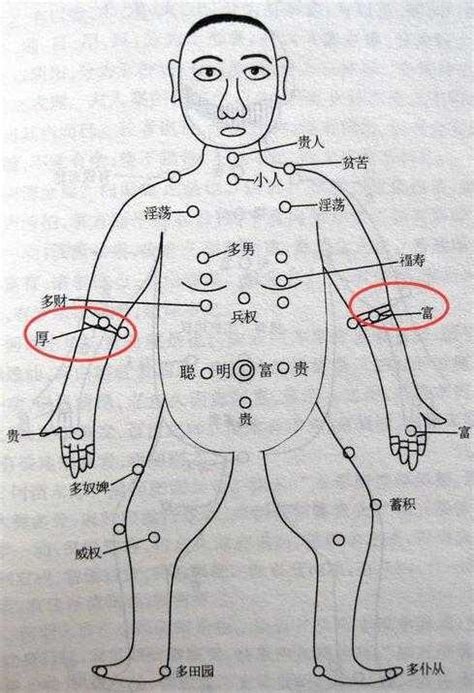 身体痣|色素痣症状